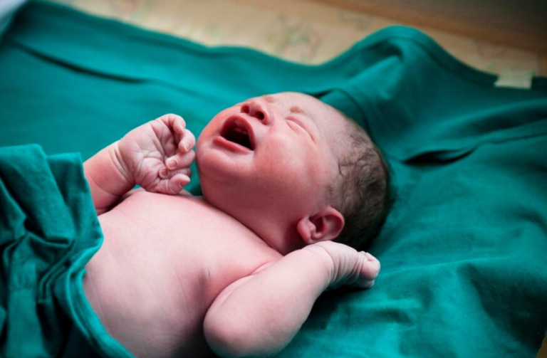 Know Everything About Newborn Jaundice - Savera Child Clinic